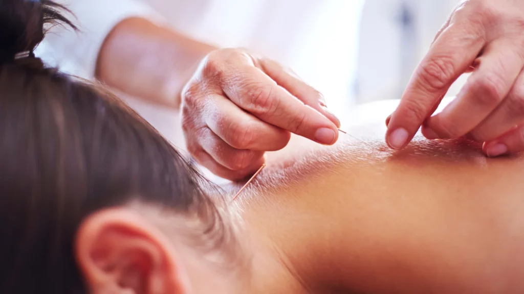 Types of Acupuncture Techniques