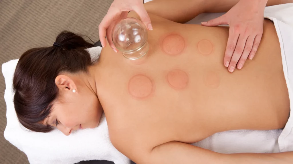 Cupping FAQs