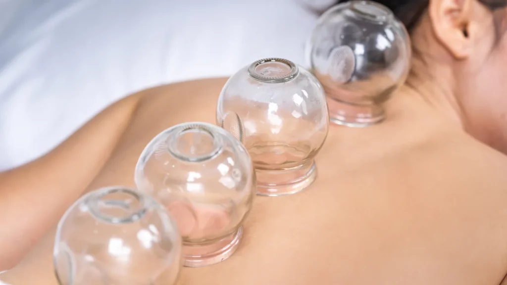 massage therapy cupping